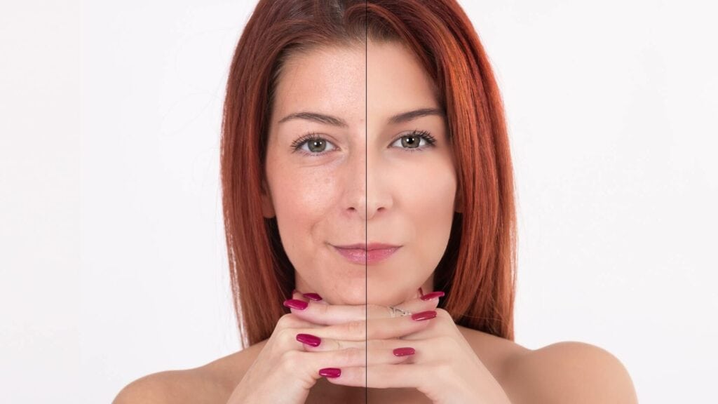 第一型膠原蛋白能夠減少細紋和皺紋，它有助於提升皮膚的彈性，使皮膚維持年輕緊緻。
